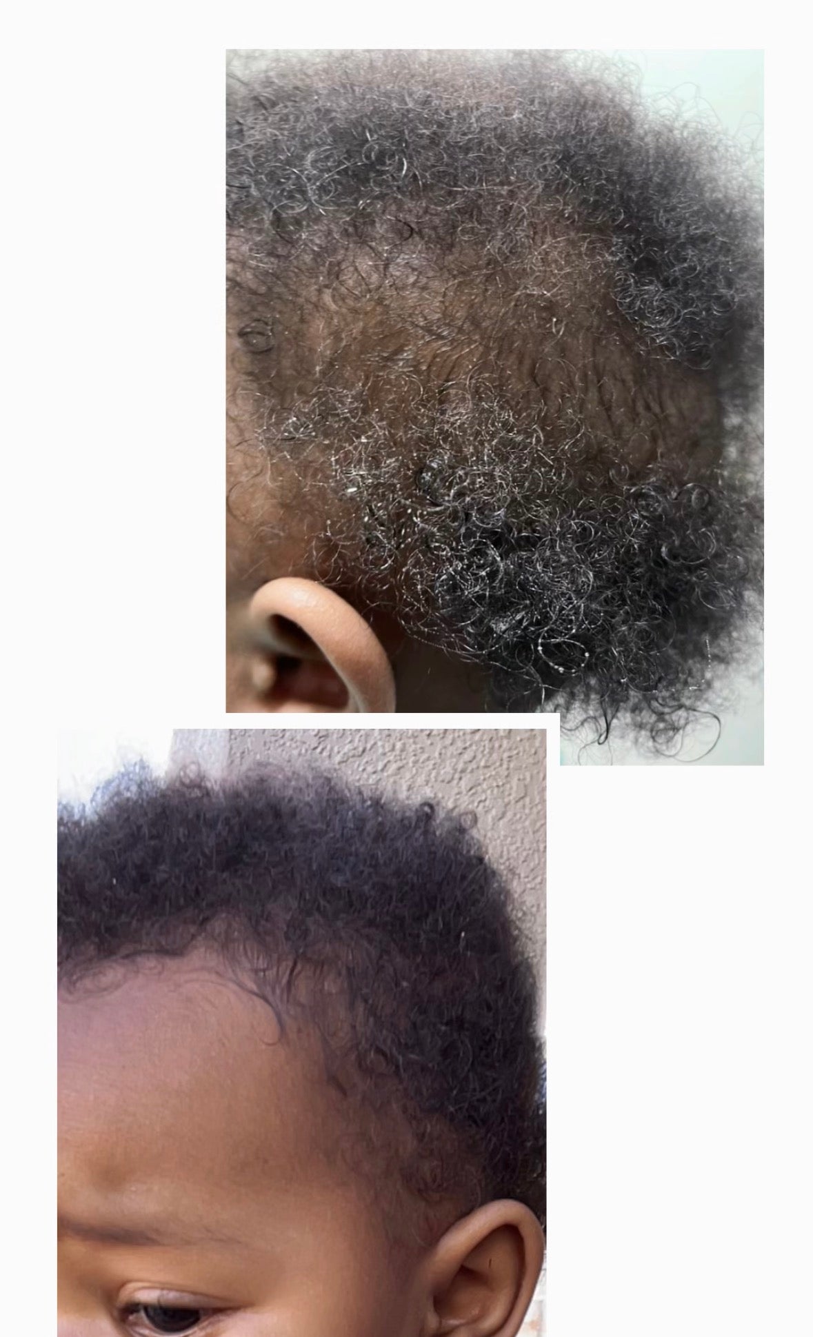 Hair Growth Oil