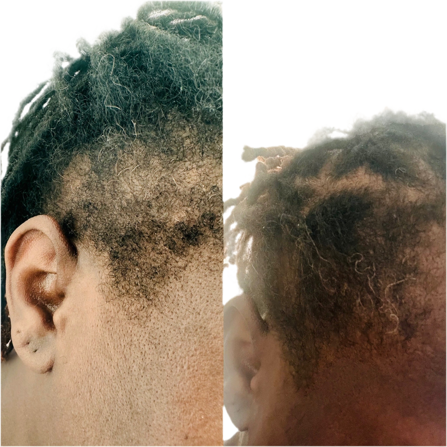 Hair Growth Oil Bundle